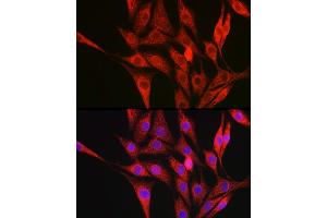 Immunofluorescence analysis of NIH/3T3 cells using Collagen III alpha 1/COL3 antibody (ABIN1679317, ABIN3018108, ABIN3018109 and ABIN6220366) at dilution of 1:100.
