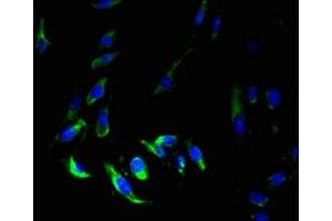 Immunofluorescent analysis of Hela cells using ABIN7159399 at dilution of 1:100 and Alexa Fluor 488-congugated AffiniPure Goat Anti-Rabbit IgG(H+L)