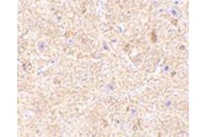 Immunohistochemistry of VISA in mouse brain tissue with this product at 2. (MAVS anticorps  (Middle Region))