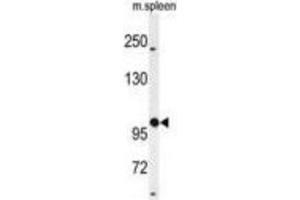 Western Blotting (WB) image for anti-UDP-N-Acetyl-alpha-D-Galactosamine:polypeptide N-Acetylgalactosaminyltransferase 5 (GalNAc-T5) (GALNT5) antibody (ABIN3004405) (GALNT5 anticorps)