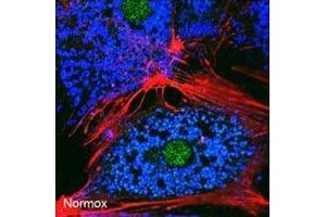 Freshly isolated mouse hepatocytes were cultured under normoxic conditions for 6 hr. (BNIP3 anticorps  (AA 152-187))