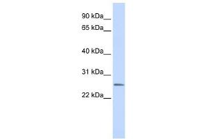 CEACAM4 antibody used at 1 ug/ml to detect target protein. (CEACAM4 anticorps  (N-Term))