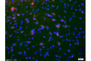 Formalin-fixed and paraffin-embedded rat brain labeled with Anti-NKB Polyclonal Antibody, Unconjugated (ABIN724460) 1:200, overnight at 4°C, The secondary antibody was Goat Anti-Rabbit IgG,Cy3 conjugated used at 1:200 dilution for 40 minutes at 37°C.