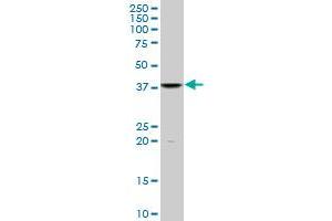 FUSIP1 monoclonal antibody (M07), clone 1G11. (SRSF10 anticorps  (AA 1-100))