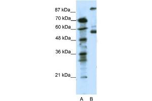 WB Suggested Anti-HTR7 Antibody Titration: 0. (HTR7 anticorps  (N-Term))