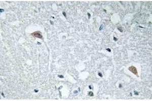 Immunohistochemistry analysis of Synapsin-1 Antibody in paraffin-embedded human brain tissue. (SYN1 anticorps)