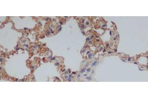 Immunohistochemistry of paraffin-embedded Rat lung using CD244 Polyclonal Antibody at dilution of 1:50 (2B4 anticorps)