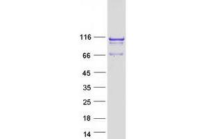 Validation with Western Blot