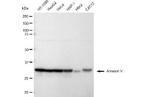 Western blotting analysis using Annexin V antibody (ABIN7797622).