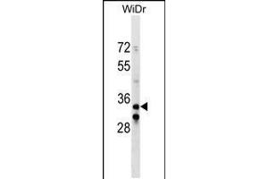 Western blot analysis in WiDr cell line lysates (35ug/lane). (ITGB1BP2 anticorps  (C-Term))