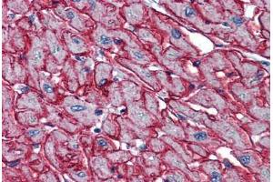 Human Heart: Formalin-Fixed, Paraffin-Embedded (FFPE)