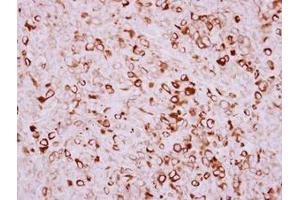 anti-Transmembrane Protease, serine 11D (TMPRSS11D) (AA 152-388) antibody