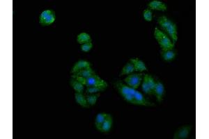 Immunofluorescence staining of HepG2 cells with ABIN7163230 at 1:200, counter-stained with DAPI.