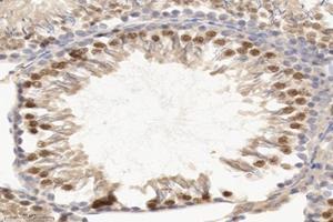 Immunohistochemistry analysis of paraffin-embedded rat testis using,TEX11 (ABIN7075862) at dilution of 1: 2000 (TEX11 anticorps)