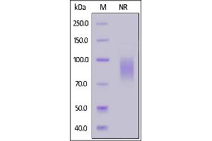 Fed Human NKG2D, Fc Tag on  under ing (NR) condition. (KLRK1 Protein (AA 73-216) (Fc Tag,FITC))