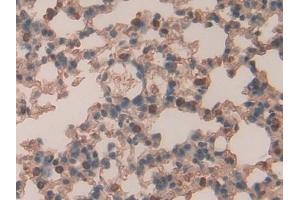 Detection of RARa in Mouse Lung Tissue using Polyclonal Antibody to Retinoic Acid Receptor Alpha (RARa)