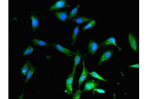 Immunofluorescent analysis of Hela cells using ABIN7142472 at dilution of 1:100 and Alexa Fluor 488-congugated AffiniPure Goat Anti-Rabbit IgG(H+L)