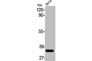 Western Blot analysis of HELA cells using ABCC13 Polyclonal Antibody (ABCC13 anticorps  (Internal Region))