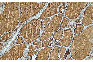 Immunohistochemistry (IHC) image for anti-Thyroglobulin (TG) (C-Term) antibody (ABIN7598797) (Thyroglobulin anticorps  (C-Term))