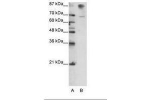 Image no. 3 for anti-HKR1, GLI-Kruppel Zinc Finger Family Member (HKR1) (C-Term) antibody (ABIN6736165) (HKR1 anticorps  (C-Term))