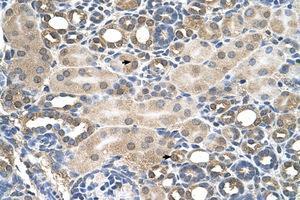 Image no. 1 for anti-Hemochromatosis (HFE) (AA 149-198) antibody (ABIN6736669)