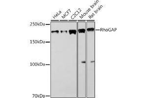 Western blot analysis of extracts of various cell lines, using RhoGAP Rabbit mAb (ABIN1682830, ABIN3016006, ABIN3016007 and ABIN7101474) at 1:1000 dilution. (ARHGAP5 anticorps)