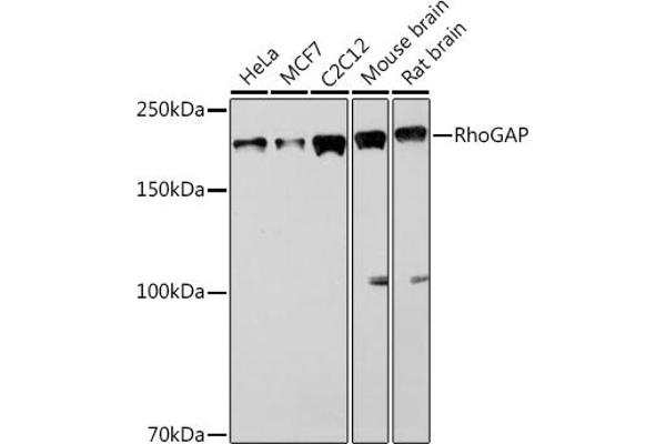 ARHGAP5 anticorps