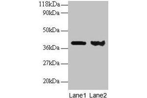 Western blot All lanes: ARHGDIA antibody at 2 μg/mL Lane 1: EC109 whole cell lysate Lane 2: 293T whole cell lysate Secondary Goat polyclonal to rabbit IgG at 1/15000 dilution Predicted band size: 24, 19 kDa Observed band size: 40 kDa