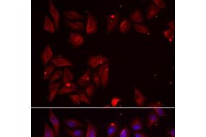 Immunofluorescence analysis of U2OS cells using PDXK Polyclonal Antibody (PDXK anticorps)