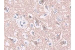 Detection of GDA in Human Cerebrum Tissue using Polyclonal Antibody to Guanine Deaminase (GDA)