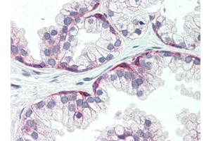 Human Prostate (formalin-fixed, paraffin-embedded) stained with SDC1at 15 µg/ml followed by biotinylated goat anti-rabbit IgG secondary antibody, alkaline phosphatase-streptavidin and chromogen. (Syndecan 1 anticorps  (AA 18-218))