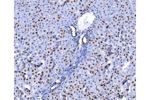 IHC analysis of U1A/SNRPA using anti-U1A/SNRPA antibody (ABIN7600891). (SNRPA1 anticorps  (AA 25-218))