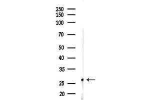 Western blot analysis of lysates from Rat brain, using FADD Antibody at 1/1000 dilution.