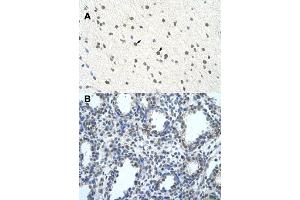 Immunohistochemical staining (Formalin-fixed paraffin-embedded sections) of human brain (A) and lung (B) with BLZF1 polyclonal antibody  at 4-8 ug/mL working concentration. (BLZF1 anticorps  (C-Term))