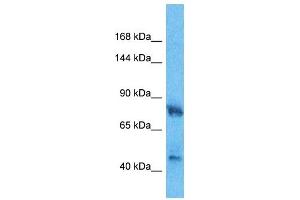 Host:  Rabbit  Target Name:  HMGCR  Sample Type:  Fetal Lung lysates  Antibody Dilution:  1. (HMGCR anticorps  (C-Term))