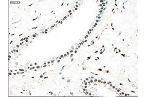 Image no. 3 for anti-Mitogen-Activated Protein Kinase Kinase 4 (MAP2K4) antibody (ABIN1499480)