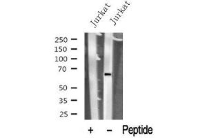 Western blot analysis of PNKP in lysates of Jurkat? (PNKP anticorps  (Internal Region))