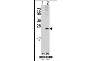 Western blot analysis of RAC1 using rabbit polyclonal RAC1 Antibody (S71). (RAC1 anticorps  (AA 49-78))