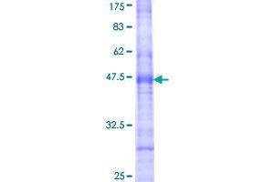 Image no. 1 for CDP-Diacylglycerol Synthase (Phosphatidate Cytidylyltransferase) 1 (CDS1) (AA 1-98) protein (GST tag) (ABIN1349042)