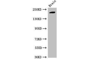Western Blot Positive WB detected in: Mouse brain tissue All lanes: RBBP6 antibody at 2. (RBBP6 anticorps  (AA 51-97))