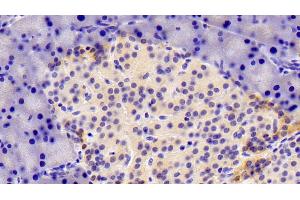 Detection of XRN1 in Rat Pancreas Tissue using Polyclonal Antibody to 5'-3'Exoribonuclease 1 (XRN1)