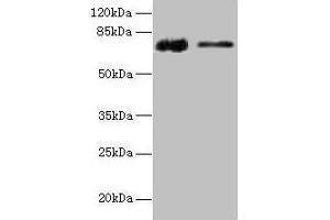 Western blot All lanes: GLCE antibody at 12 μg/mL Lane 1: Rat liver tissue Lane 2: Mouse kidney tissue Secondary Goat polyclonal to rabbit IgG at 1/10000 dilution Predicted band size: 71 kDa Observed band size: 71 kDa (GLCE anticorps  (AA 29-617))