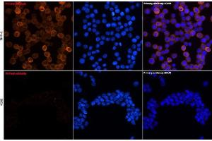 Immunofluorescence analysis of THP-1 and K562 cells using YKL-40/CHI3L1 Rabbit mAb (ABIN7266328) at dilution of 1:100 (40x lens). (CHI3L1 anticorps)