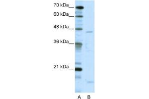 WB Suggested Anti-TRIAntibody Titration:  5.