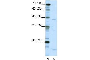 WB Suggested Anti-TRIAntibody Titration:  5. (TRIP13 anticorps  (C-Term))