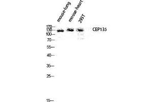 Western Blot (WB) analysis of Mouse Lung Mouse Heart 293T lysis using CEP135 antibody. (CEP135 anticorps  (C-Term))