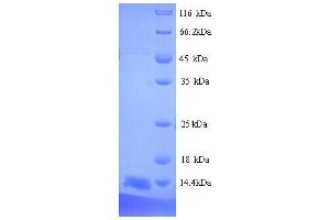 SDS-PAGE (SDS) image for Prostate Stem Cell Antigen (PSCA) (AA 21-95) protein (His tag) (ABIN5713764) (PSCA Protein (AA 21-95) (His tag))