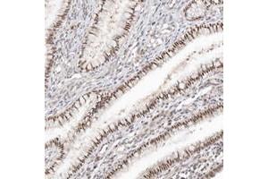 Immunohistochemical staining of human cervix, uterine, with LARP7 polyclonal antibody  shows nuclear positivity in glandular cells. (LARP7 anticorps)