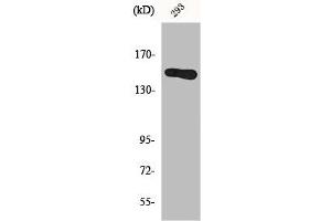 Western Blot analysis of 293 cells using GAK Polyclonal Antibody (GAK anticorps  (N-Term))