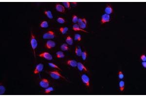 IF analysis of CARS using anti-CARS antibody (ABIN5692995) CARS was detected in immunocytochemical section of U20S cell. (CARS anticorps  (AA 510-748))